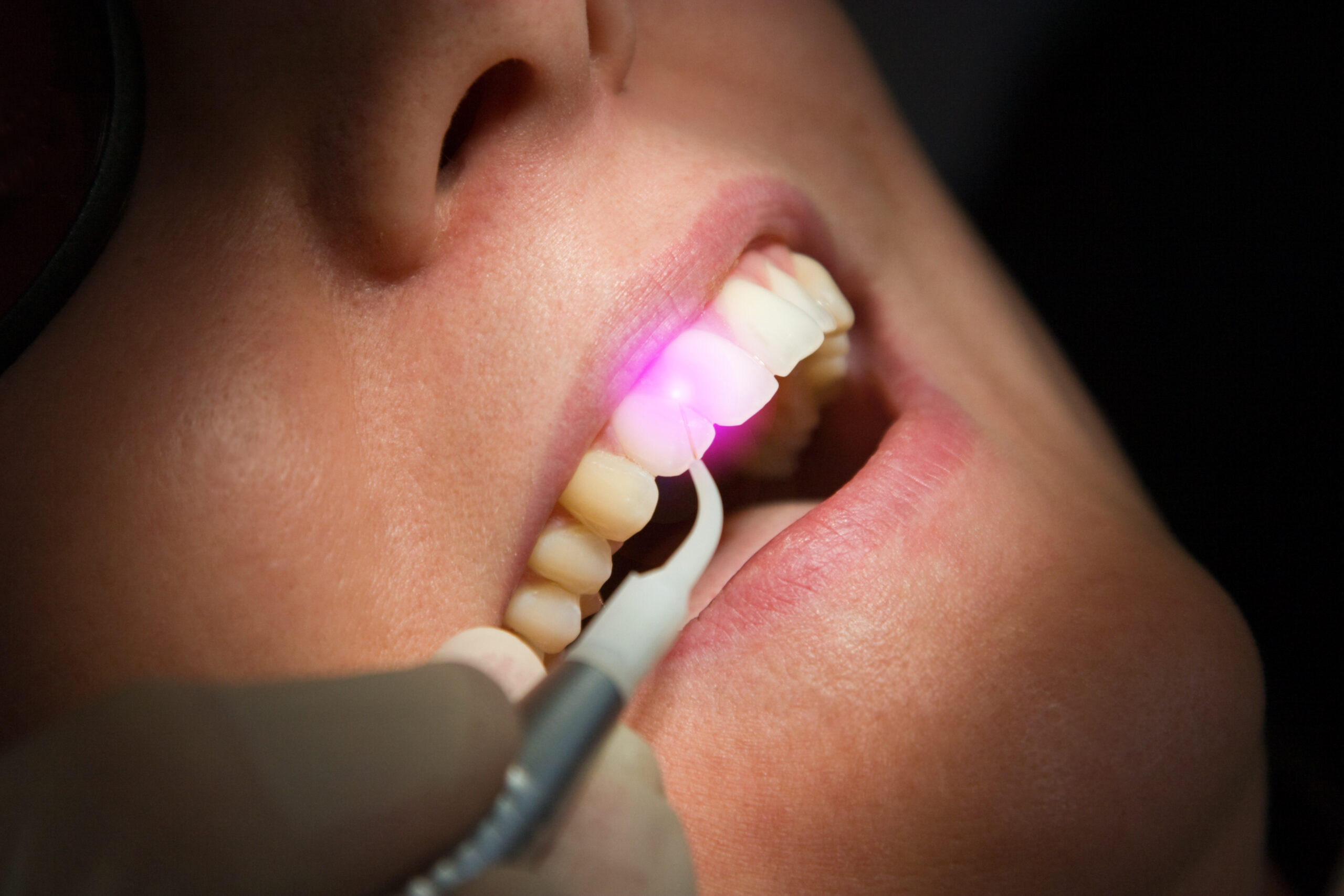 AdobeStock 20723079 scaled - Gardens Dentistry Palm Beach