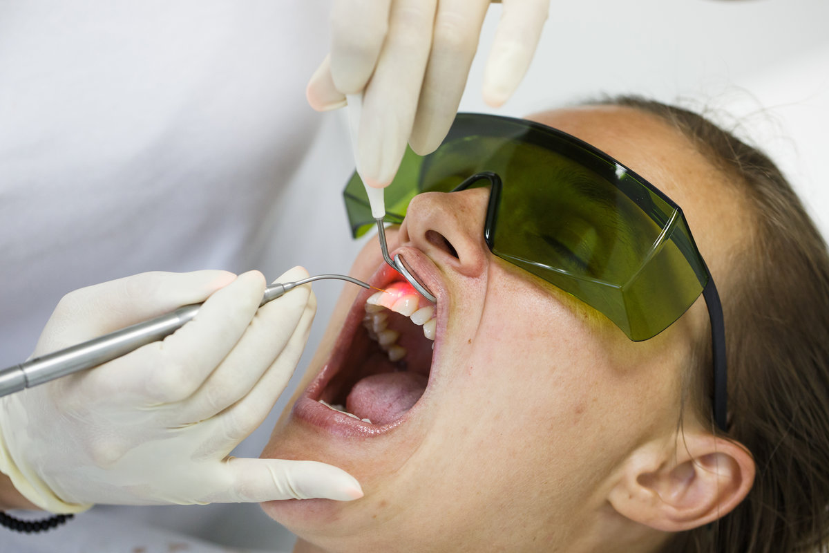 Dentist using a modern diode dental laser for periodontal care. Patient wearing protective glasses, preventing eyesight damage. Periodontitis, dental hygiene, preventive procedures concept.Ê
